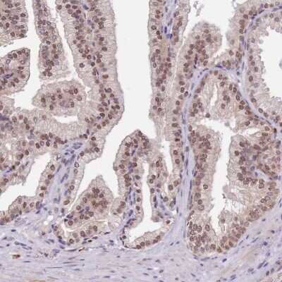 Immunohistochemistry-Paraffin: FAM120AOS Antibody [NBP2-14493]