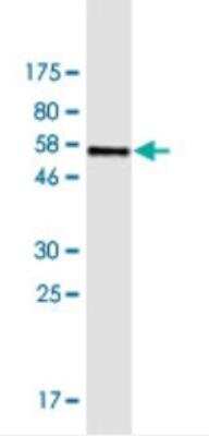Western Blot: FAM122A Antibody (3E9) [H00116224-M03]