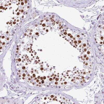 Immunohistochemistry-Paraffin: FAM122A Antibody [NBP2-31646]