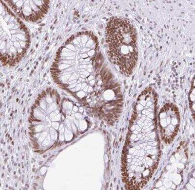 Immunohistochemistry-Paraffin: FAM122A Antibody [NBP2-31646]