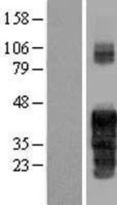 Western Blot: FAM122A Overexpression Lysate [NBP2-05657]