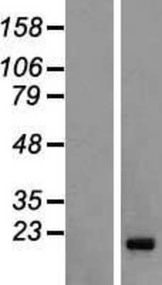 Western Blot: FAM122C Overexpression Lysate [NBL1-10459]