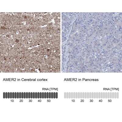 Immunohistochemistry-Paraffin: FAM123A Antibody [NBP1-93907]