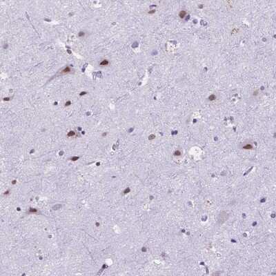Immunohistochemistry-Paraffin: FAM124B Antibody [NBP2-49625]