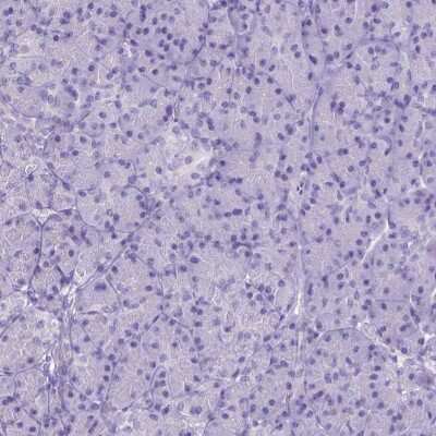 Immunohistochemistry-Paraffin: FAM124B Antibody [NBP2-49625]