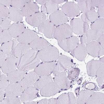 Immunohistochemistry-Paraffin: FAM124B Antibody [NBP2-49625]