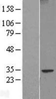 Western Blot: FAM124B Overexpression Lysate [NBL1-10460]