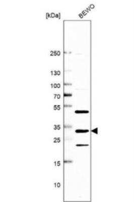 Western Blot: FAM125A Antibody [NBP1-91882]