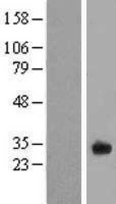 Western Blot: FAM125A Overexpression Lysate [NBL1-10461]