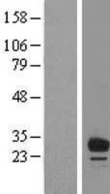 Western Blot: FAM125B Overexpression Lysate [NBL1-10462]