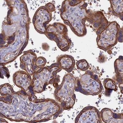 Immunohistochemistry-Paraffin: FAM126A Antibody [NBP2-13980]