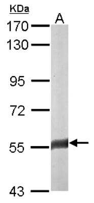Western Blot: FAM126A Antibody [NBP1-32914]