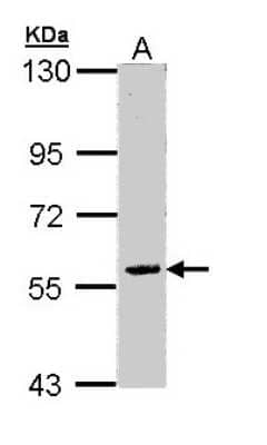 Western Blot: FAM126A Antibody [NBP1-32914]