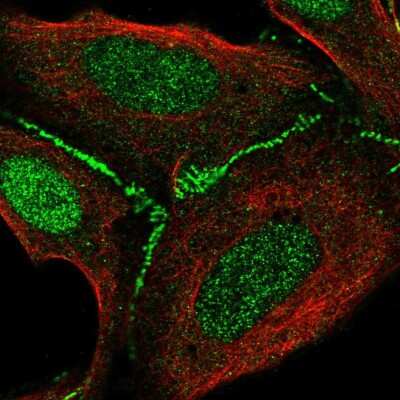 Immunocytochemistry/ Immunofluorescence: FAM126B Antibody [NBP2-57122]