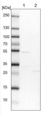 Western Blot: FAM126B Antibody [NBP1-81636]