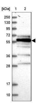 Western Blot: FAM126B Antibody [NBP2-34026]