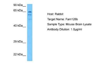 Western Blot: FAM126B Antibody [NBP2-87404]