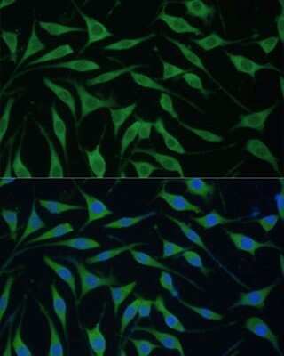 Immunocytochemistry/ Immunofluorescence: FAM127B Antibody - Azide and BSA Free [NBP3-05644]