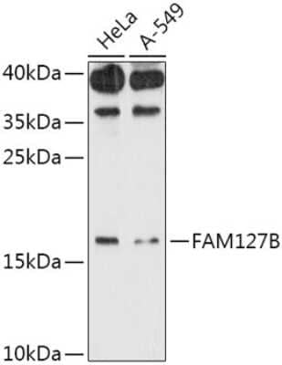 Western Blot: FAM127B AntibodyAzide and BSA Free [NBP3-05644]