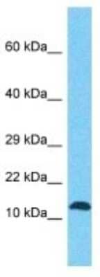 Western Blot: FAM127B Antibody [NBP3-10775]