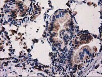 Immunohistochemistry: FAM127C Antibody (OTI1A6) [NBP2-45699]