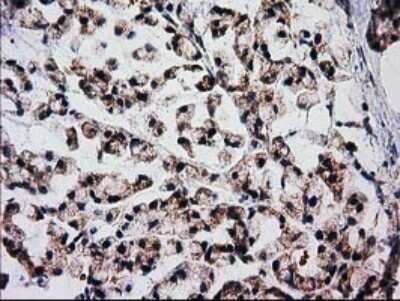 Immunohistochemistry: FAM127C Antibody (OTI1A6) [NBP2-45699]