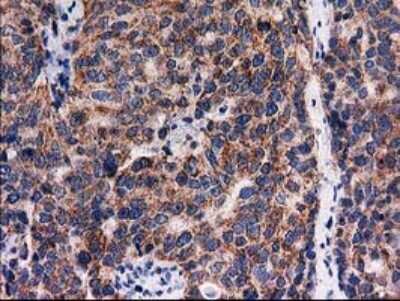 Immunohistochemistry: FAM127C Antibody (OTI1A6) [NBP2-45699]