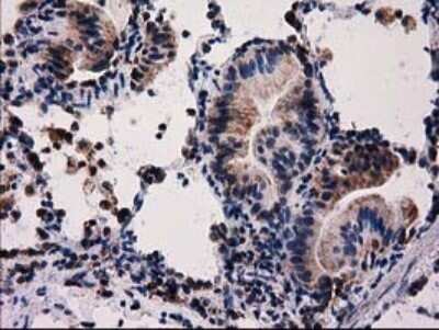 Immunohistochemistry: FAM127C Antibody (OTI1A6) - Azide and BSA Free [NBP2-71867]