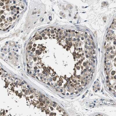 Immunohistochemistry-Paraffin: FAM129B Antibody [NBP1-88785]