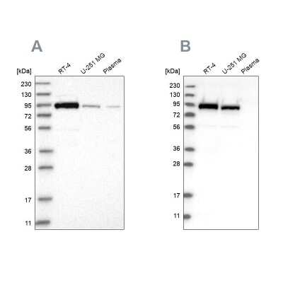 Western Blot: FAM129B Antibody [NBP1-88782]