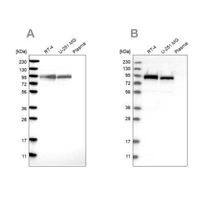 Western Blot: FAM129B Antibody [NBP1-88783]