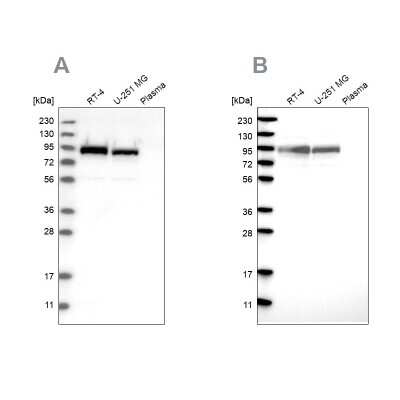 Western Blot: FAM129B Antibody [NBP1-88784]