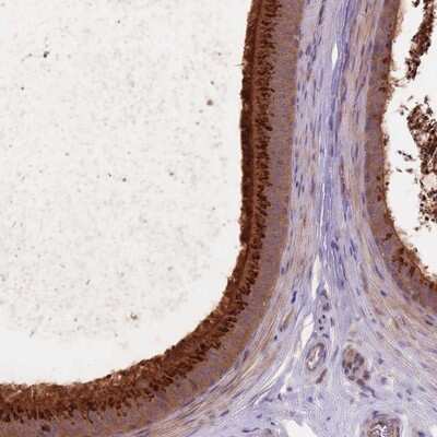 Immunohistochemistry-Paraffin: FAM12A Antibody [NBP2-13945]