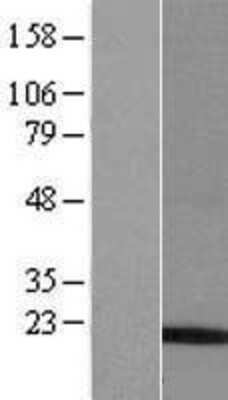 Western Blot: FAM12B Overexpression Lysate [NBP2-06441]