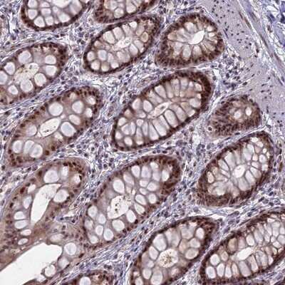Immunohistochemistry-Paraffin: FAM131A Antibody [NBP1-91167]