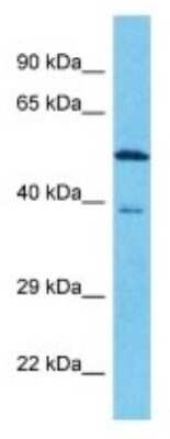 Western Blot: FAM131B Antibody [NBP3-10724]