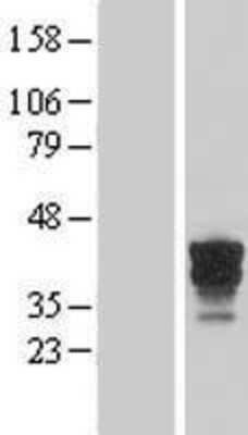 Western Blot: FAM131B Overexpression Lysate [NBL1-10471]