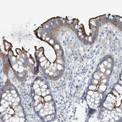Immunohistochemistry-Paraffin: FAM131C Antibody [NBP2-13981]