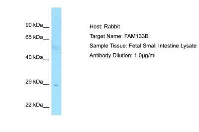 Western Blot: FAM133B Antibody [NBP1-98589]