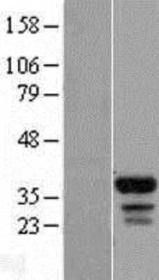 Western Blot: FAM133B Overexpression Lysate [NBL1-10473]