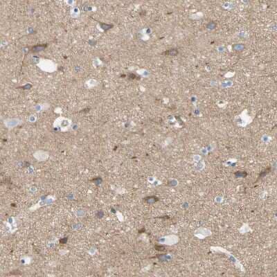Immunohistochemistry-Paraffin: FAM134A Antibody [NBP1-91168]