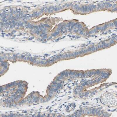 Immunohistochemistry-Paraffin: FAM134A Antibody [NBP1-91168]