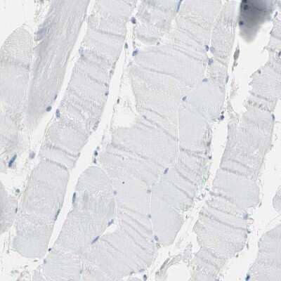 Immunohistochemistry-Paraffin: FAM134A Antibody [NBP1-91168]