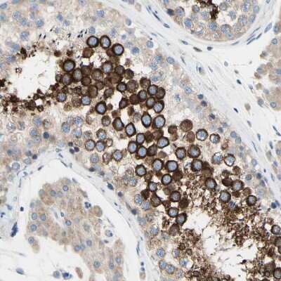 Immunohistochemistry-Paraffin: FAM134A Antibody [NBP1-91168]