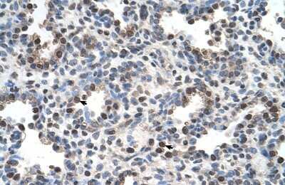 Immunohistochemistry-Paraffin: FAM134B Antibody [NBP1-59817]