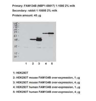 Western Blot: FAM134B Antibody [NBP1-59817]