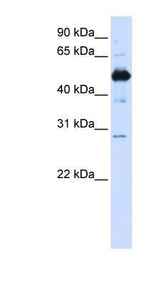 Western Blot: FAM134B Antibody [NBP1-59924]