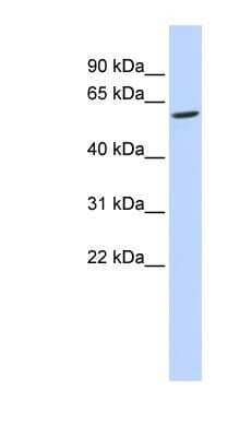 Western Blot: FAM134C Antibody [NBP1-60104]