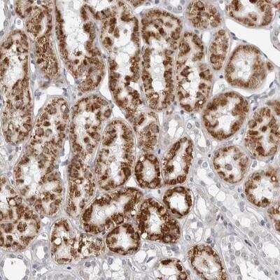 Immunohistochemistry: FAM135B Antibody [NBP1-86716]