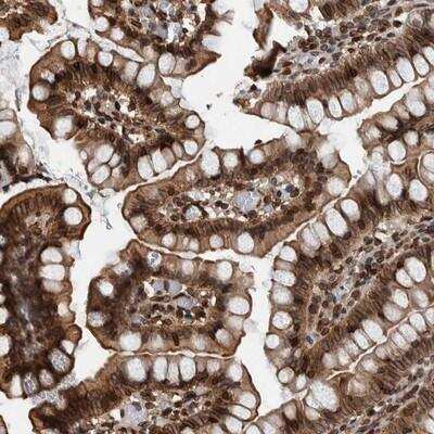 Immunohistochemistry-Paraffin: FAM135B Antibody [NBP1-86717]